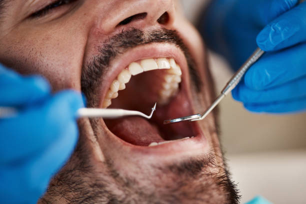 Best Pediatric Emergency Dentist in Belzoni, MS