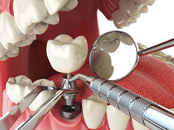 Best Emergency Dental Care for Trauma or Injury in Belzoni, MS